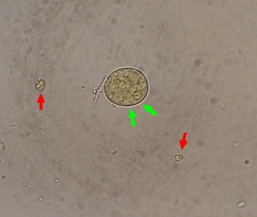 22 (27) 5.1. ALKUELÄIMET Entamoeba histolytica o Entamoeba histolytican kysta on pyöreä ja sen halkaisija on noin 12 15 µm. o Kypsässä kystassa on neljä tumaa.