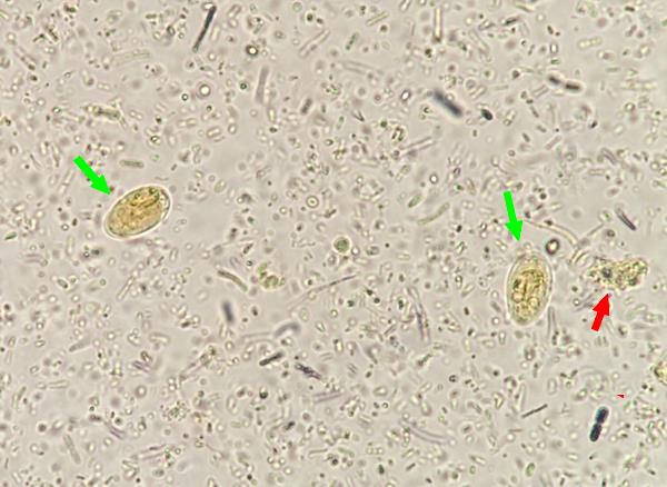 23 (27) Giardia lamblia o Kystat ovat pyöreitä tai ovaalinmuotoisia, yleensä 8 19 µm kokoisia.