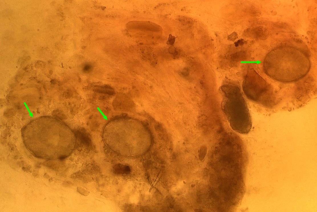 25 (27) Diphyllobothrium latum o o Munat ovat yleensä noin 58 75 x 40 50 µm kokoisia ja soikeita.