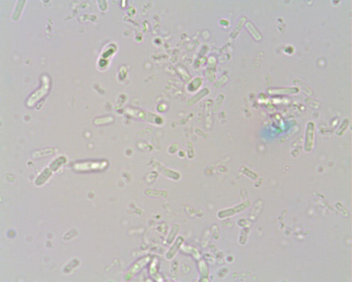 Bacillus thuringiensis.