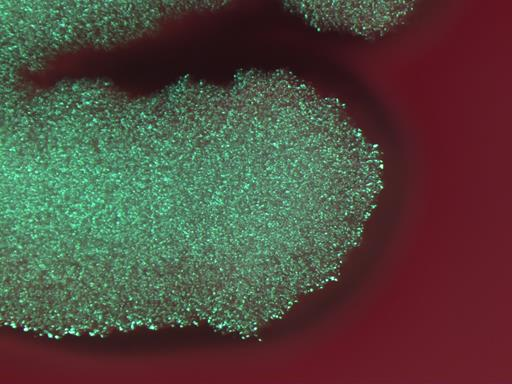 Bacillus thuringiensis (Bt) 2(2) Lajistatus kyseenalainen eroaa Bc:stä vain toksiinikiteitä koodaavia cry-geenejä sisältävän plasmidin/plasmidien osalta