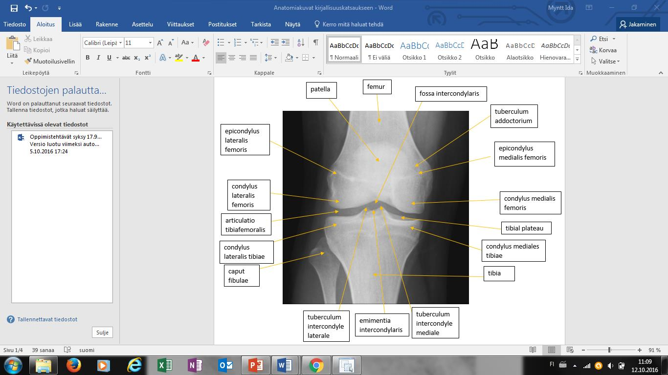 18 Kuva 1. Polven luinen anatomia AP-kuvassa. (e-anatomy, Micheau A., Hoa D., www.imaios.com) 4.2.2 Sivukuva Sivukuvan kontrastin pitää olla riittävä, jotta rasvatyynyt näkyvät kuvassa.