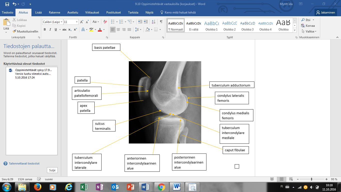 19 Kuva 2. Polven luinen anatomia sivukuvassa. (e-anatomy, Micheau A., Hoa D., www.imaios.com) 4.3 