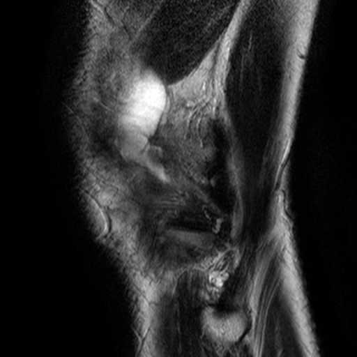 Röntgen vs MRI 21 DEE-11000