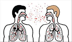 38 Liite 2 RISK OF GETTING INFECTED * Exposure duration, times, contact space and coughing habits ENVIROMENTAL * Inappropriate caring space and weak ventilation FACTORS * Inadequate and insufficient