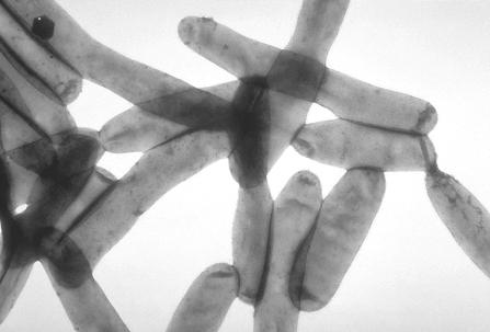 12 KUVA 3. Legionella bakteeri. (Välineva 2011). Muita ei-ulosteperäisiä bakteereja ovat Mycobakterium ja Staphylococcus aureus.