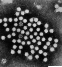 16 4 Astrovirukset Ihmisen astroviruksia on kuvattu ensimmäistä kertaa vuonna 1975 elektronimikroskoopilla. Astrovirusten sukuun kuuluvat sekä ihmisten että eläinten astrovirukset.