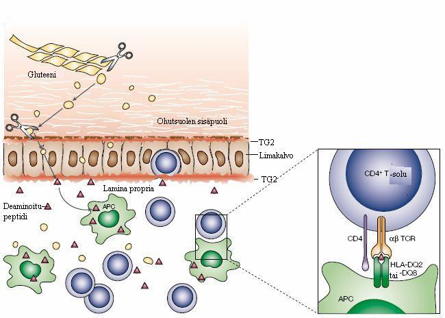 Kuva 2.1. Keliakian patogeneesi. (Mukaillen Sollid, 2002.
