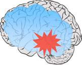 Taistele, pakene tai innovoi (Nathalie Wilde & Functions of the two Zones The Red Zone Focused on self Sensitive to threat Engages fight/flight Resistant to change Low order learning only