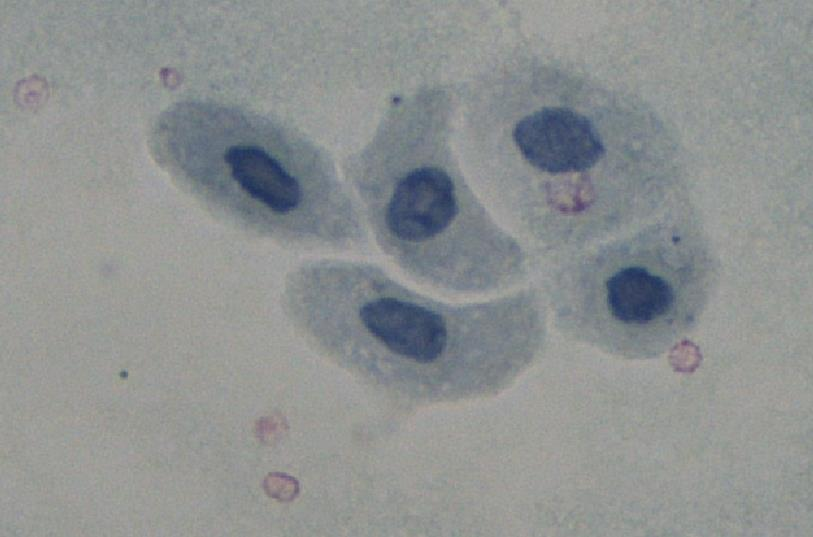 11 2.3.1 Uroteelin solut Välimuotoisen epiteelin eli uroteelin solut vaihtelevat kooltaan (Kuva 3).