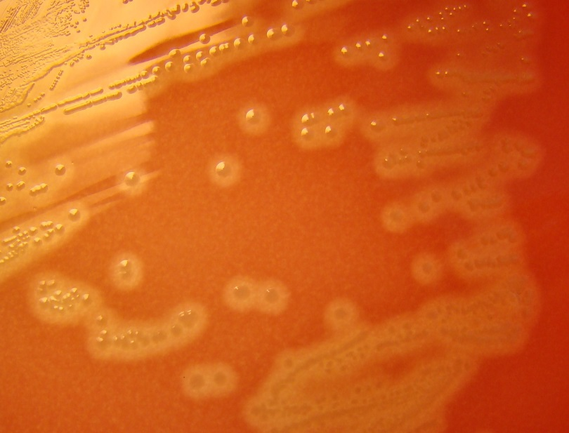 Streptococcus pyogenes Grampositiivinen ketjukokki A + G - Kasvu
