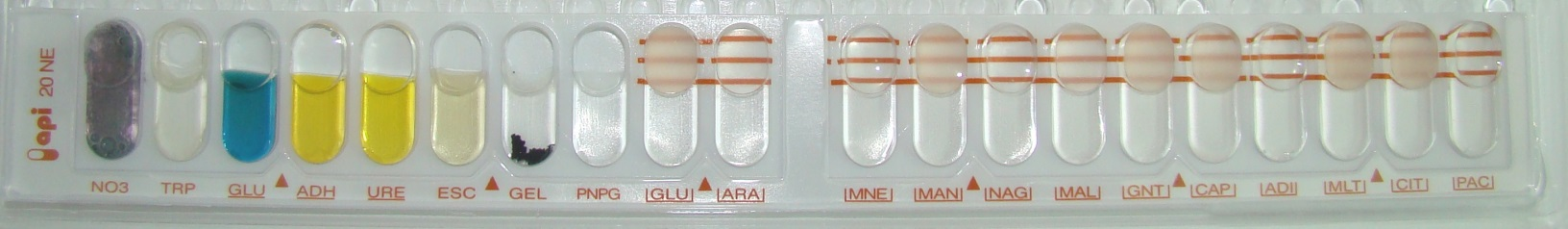 Näyte 12/2014. 2. Pseudomonas stutzeri 1. API20NE 0044655 Pseudomonas stutzeri (99,9%).