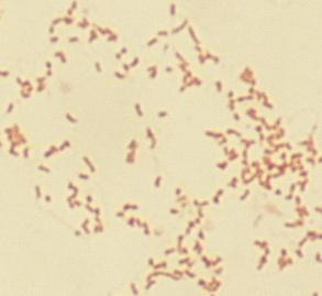 actinomycetemcomitans Satelliittikoe