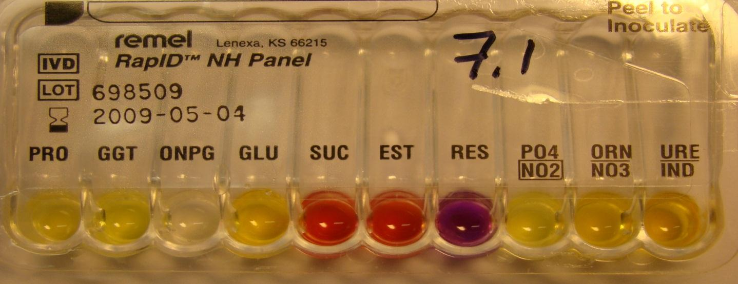 Näyte 33/2015 (7/2009). 1. Aggregatibacter actinomycetemcomitans 1.