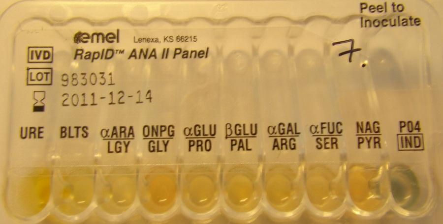 RapID ANA II: 000006 Fusobacterium nucleatum (100