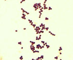 ryhmä F (Streptococcus anginosus)