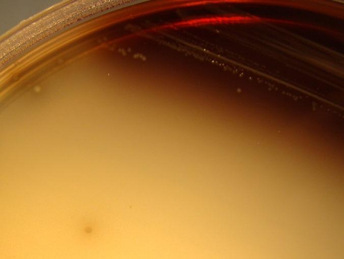 Näyte 23/2015 (3/2013). 1. Enterococcus faecalis 1a.