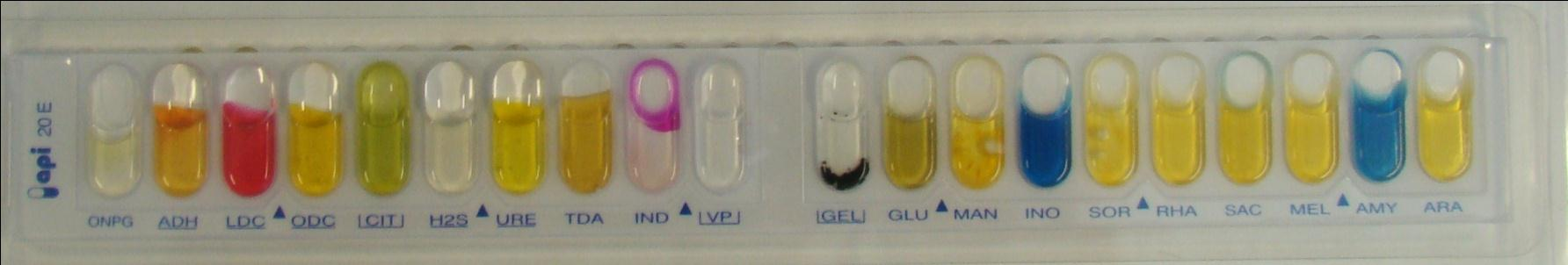 Näyte 24/2015 (6/2012) 1. Escherichia coli 1.