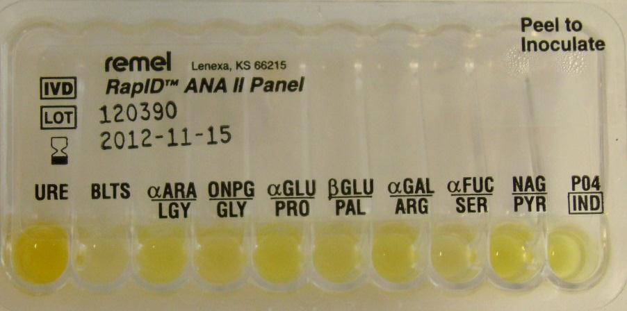 Näyte 24/2015 (12/2012). 2. Bacteroides ovatus 1.