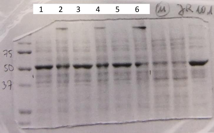 27 9.3 Proteiinimittausten tulokset Geelissä numero 11 käytettiin CHS-proteiiniin kiinnittyvää primaarivasta-ainetta, joka toimi tässä