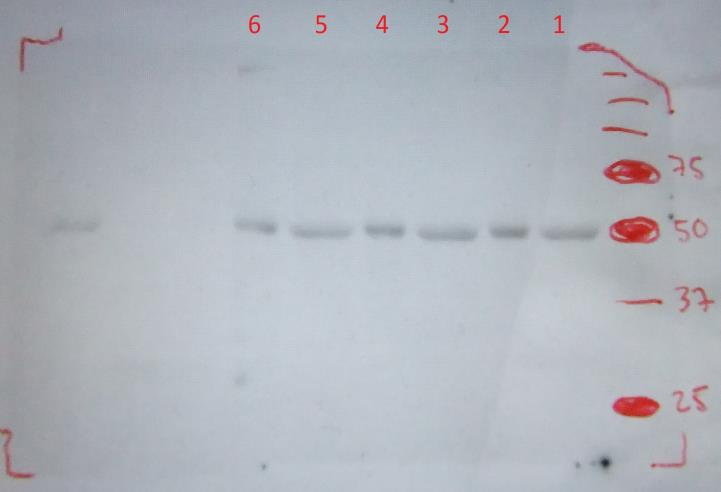 Nämä CHSproteiinikuvat kertovat, että coomassie-värjäys ja immunoblottaus ovat onnistuneet ja ne on tehty oikein.