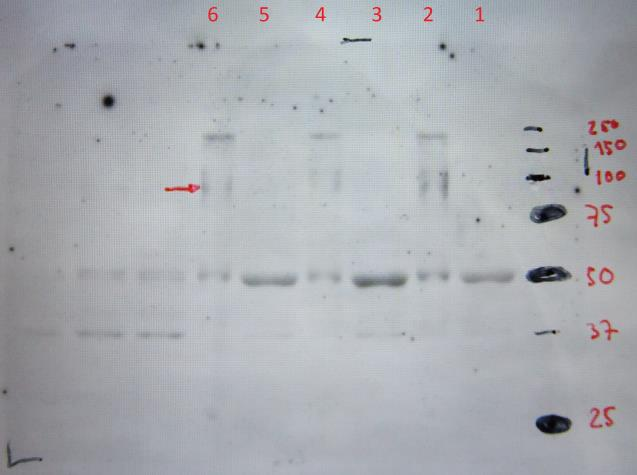 Geelissä 12 käytetyt vastaainemäärät olivat suuremmat ja kyseisessä geelissä voidaan havaita näytteissä 2, 4 ja 6 proteiiniraidan reunat massan 81,5 kd kohdalla (kuvio 12 ja 13). Kuvio 12.