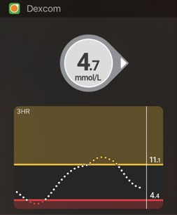 Tänään-näkymä (vain Apple) Lisää CGM Tänään-näkymääsi. Käyttöönotto 1. Avaa Tänään-näkymä. Katso lisätietoja älylaitteesi ohjeista. 2.