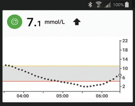 Pikavilkaisu (vain Android) Pikavilkaisu näyttää CGM:si ilmoitusalueella. Pyyhkäise alas näytön yläreunasta tarkistaaksesi sen. Avaa sovellus napauttamalla Pikavilkaisua.