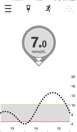 Tässä vaiheessa sinun tulisi jo tietää, milloin voit ja milloin et voi tehdä hoitopäätöksiä Dexcom G5 Mobile CGM -järjestelmän anturin glukoosilukemien perusteella.