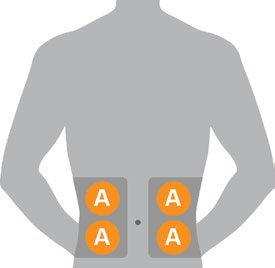 Ennen anturin asettimen poistamista steriilistä pussista, määrittele, mikä on paras paikka anturin asettamiseen. 5.