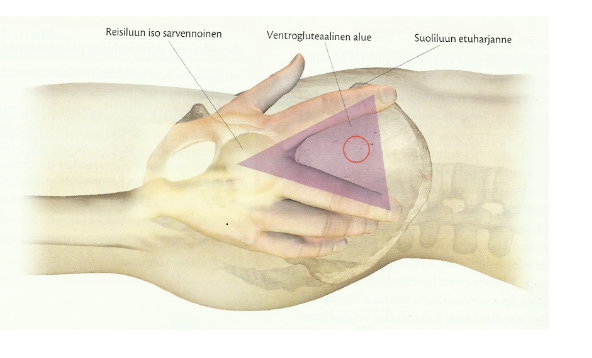 14 Kuva 1. Ventrogluteaalisen alueen paikantaminen. (Saano & Taam-Ukkonen 2013, 241.) Ventrogluteaalinen alue ei ole pistopaikkana uusi. Hochsetter on suositellut sitä injektiopaikaksi jo vuonna 1954.