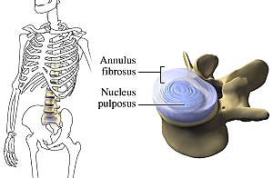 12 Välilevyn ydin (nucleus pulposus) on hyvin kehittynyt rangan rakenne (kuva 7). Se on hyytelömäinen ja vettä sitova, geelimäinen massa, jota ympäröi syykehä (annulus fibrosus).