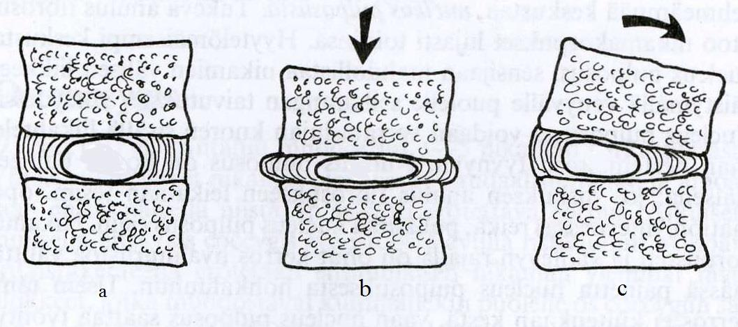 29 Kuva 20. Veden siirtyminen a. ulos välilevystä kuormituksen vuoksi ja b. sisään ytimen imiessä kuormituksen vähentyessä (Kapandji 1997, 35).