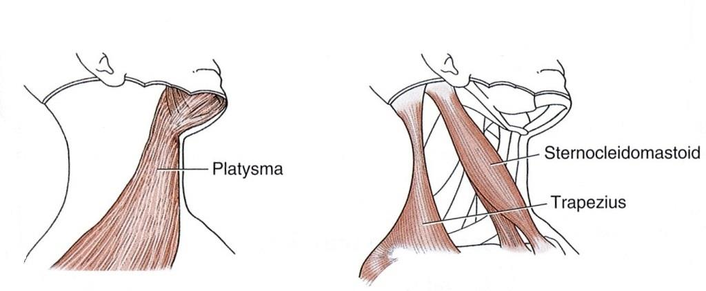 17 Musculus sternocleidomastoideus (SCM) on parillinen, kaksipäinen lihas. SCM kiertää ohimoluun lateraalipuolelta hartiarenkaan ventraalipuolelle, jossa se kiinnittyy solisluun lisäksi rintalastaan.