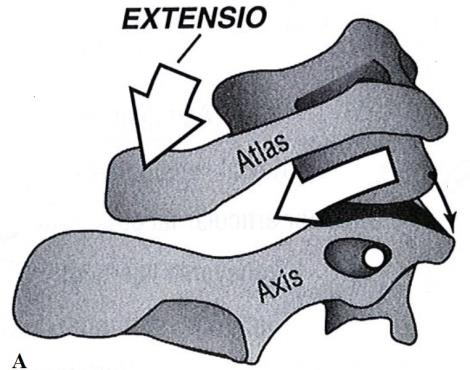 kaularangan flexoreihin. Kaularangan extensorit joutuvat toimimaan painovoimaa vastaan. (Kapandji 1997, 216.