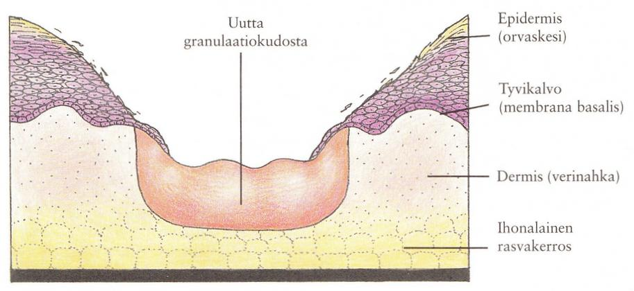 KUVA 1. Granulaatiokudoksen muodostuminen (Jensen ym. 1999, 12). Viimeisenä on maturaatio- eli kypsymisvaihe, joka kestää muutamasta kuukaudesta useisiin vuosiin.