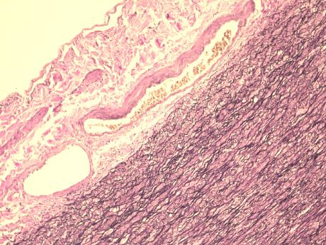 31 KUVA 10. Arterian seinämän elastiset säikeet ovat värjäytyneet mustiksi Värjäystuloksessa elastiset säikeet sekä tumat ovat mustia (kuva 10).