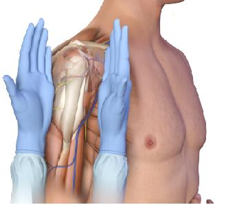 28 Kun toimenpiteen suorittajan toinen käsistä on asetettu potilaan olkapään rintakehän puoleiselle sivulle, tulee seuraavaksi toimenpiteen suorittajan asettaa käden kämmensivu olkapään