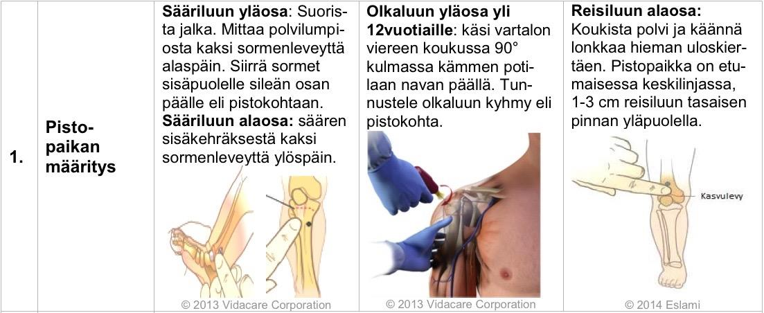 54 Kuva 10. Lasten luuydinyhteyden toimintaohjeen osio 1: Pistopaikan määritys.