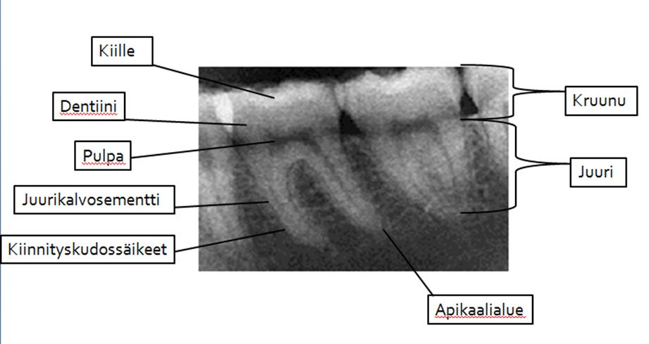 7 (34) 2 LEUKOJEN JA HAMPAISTON RAKENNE Tarvitaan vankkaa tietämystä leukojen ja hampaiston normaalin anatomisen rakenteen vaihtelusta ja ilmenemisestä röntgenkuvassa, jotta diagnoosin tekeminen