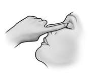 7 4. Slut ögat och tryck med fingret i den inre ögonvrån under ca en minut. På så sätt undviker du att ögondroppen rinner ner i tårkanalen. Tillslut flaskan.