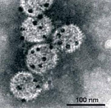 46 Kuva 12. TEM- kuva muokatuista viruksista, joissa mustat pisteet oksidipartikkeleja. (Muokattu lähteestä: Cormode ym.