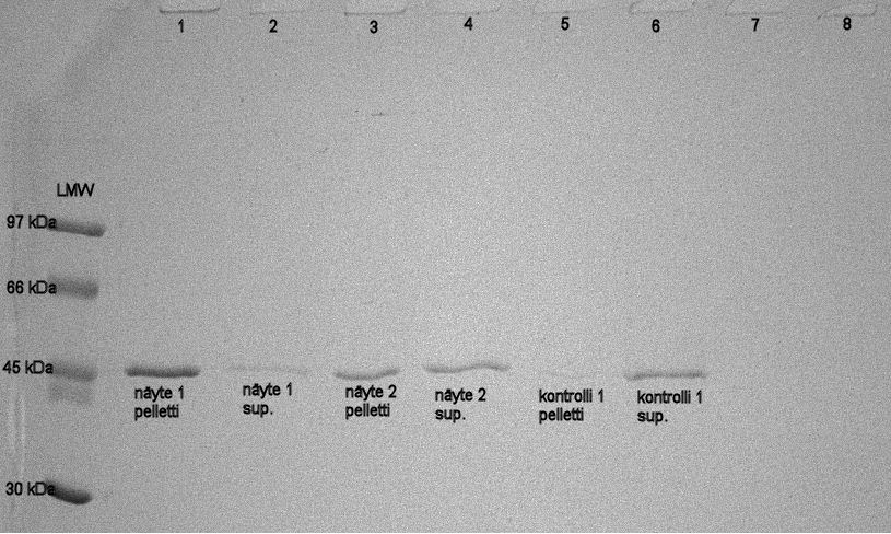 30 4.6 Solujen värjäytyminen ja leimaus IPEC-1-soluja värjättiin usealla eri tekniikalla, joista kaikki olivat lähes yhtä toimivia.