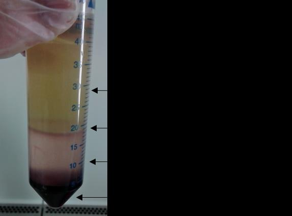 30 Monosyyttien eristämisen aluksi pipetoitiin 15 ml Ficoll-liuosta neljään 50 ml sentrifugiputkeen. Veripussia sekoiteltiin varovasti, katkaistiin letku ja valutettiin verinäyte 250 ml pulloon.