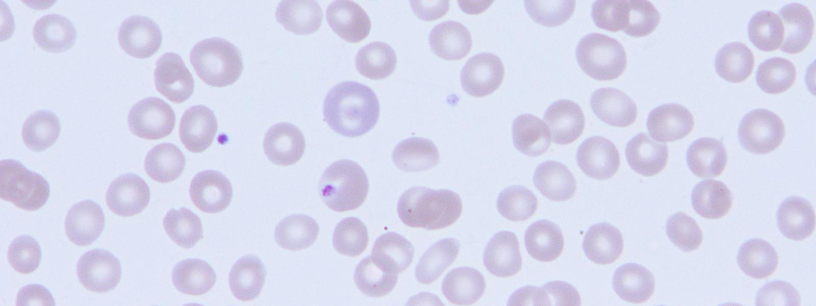 Kantasolutasolta kypsän punasolun muodostumiseen kuluu noin kaksi viikkoa. (Siitonen Koistinen 2007: 25.) 4.