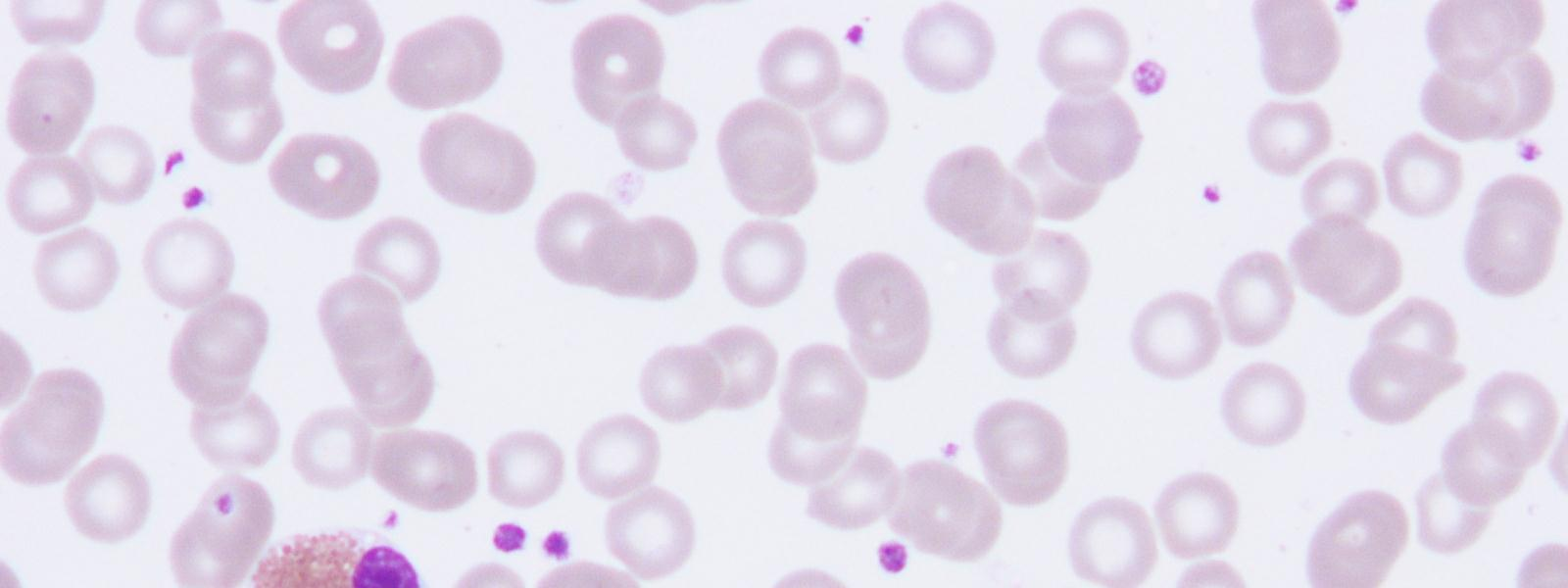 15 soluista myelosyyttitasolla. Tähän asti eosinofiilit ja basofiilit käyvät läpi samat kypsymisasteet kuin neutrofiilisarjan solut. (Siitonen Koistinen 2007: 27.