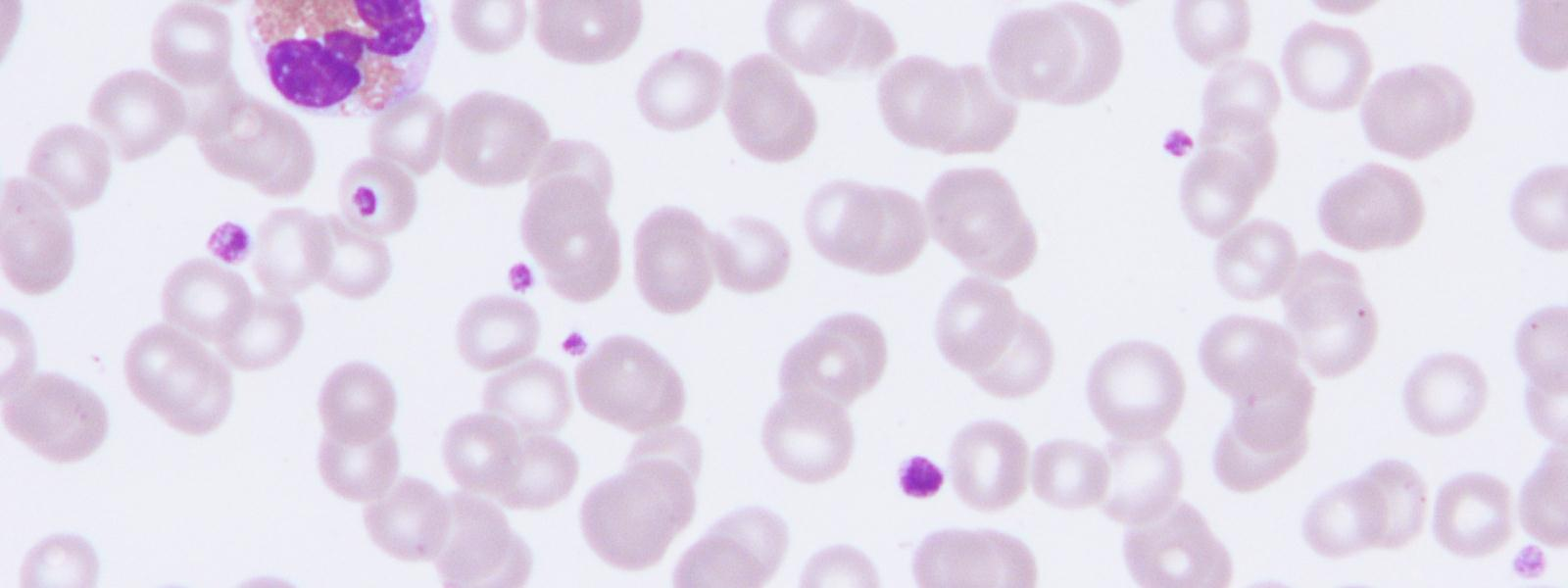Liuskatumaisen eosinofiilin sytoplasma on tyypillisesti karkea ja siinä on syvänpunaiseksi värjäytyviä granuloita, kun taas liuskatumaisilla basofiileilla granulat ovat tummansinisiä.