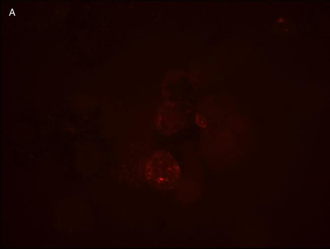 31 Kuvassa 7 A on linjan A116 10 %:nen Bestrophin-1-näyte ja B on linjan A116 10 %:nen MITF-näyte kuvattuna fluoresenssimikroskoopilla.