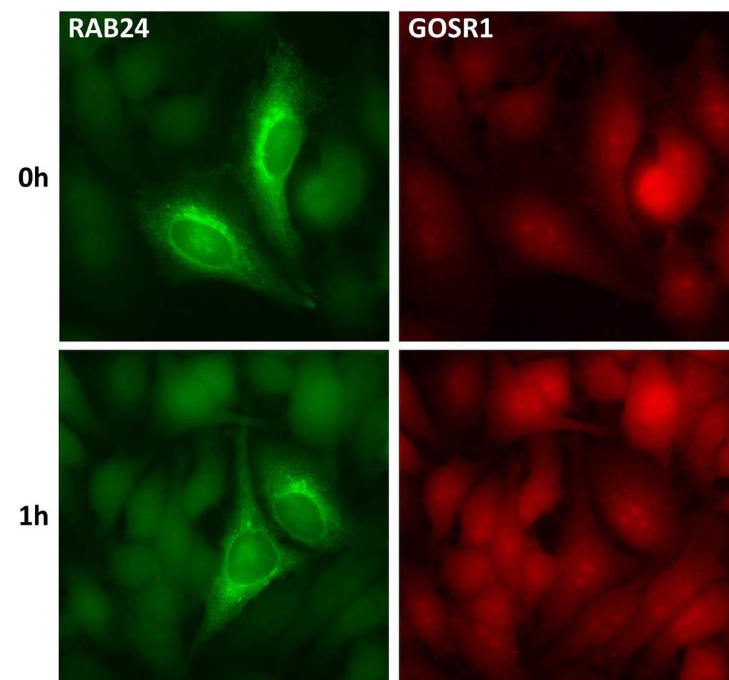 Kuva 4-1: HeLa-solut transfektoitiin RAB24:llä, fiksoitiin ja immunofluoresenssileimattiin anti- RAB24:llä ja anti-gosr1:llä.
