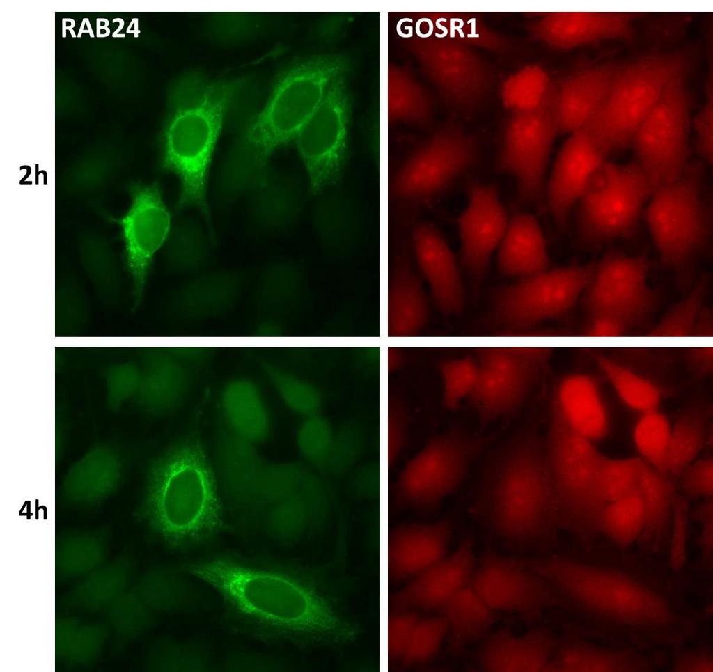 Kuva 4-2: HeLa-solut transfektoitiin RAB24:llä, fiksoitiin ja immunofluoresenssileimattiin anti- RAB24:llä ja anti-gosr1:llä.